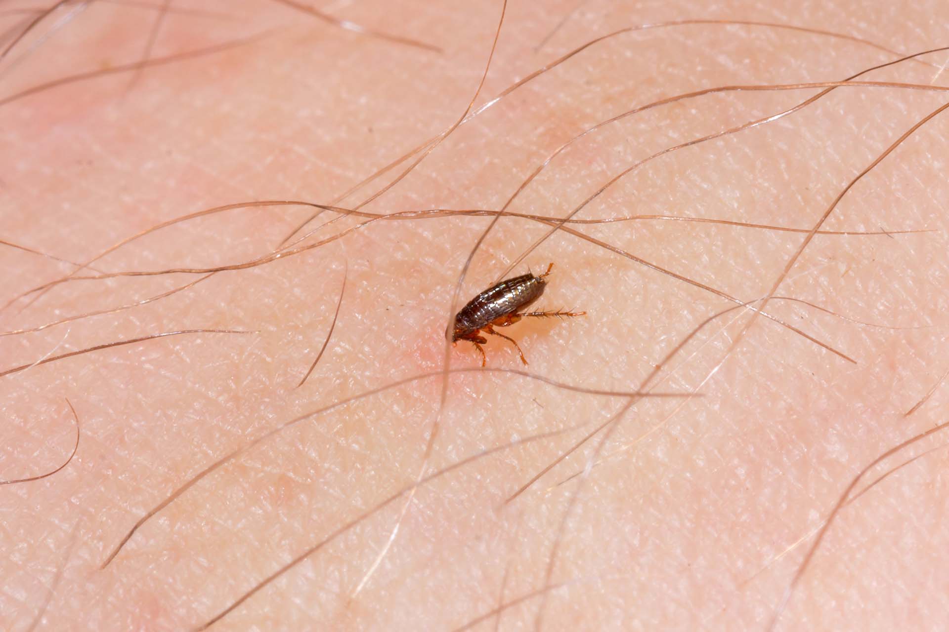 Flea Control - Picture of a flea on human skin, showing red skin and hair